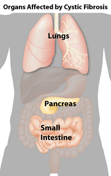 Affected Organs